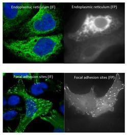  IF vs GFP till HPA blog 2015.jpg